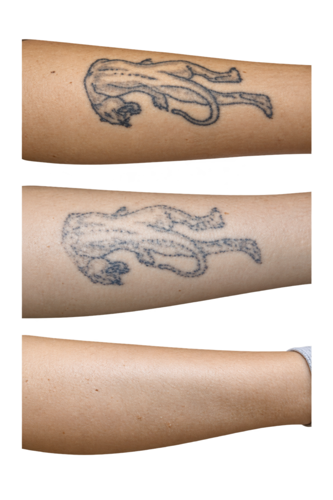 Tattoo voorarm 3 stappen weg